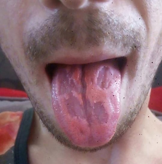 tongue